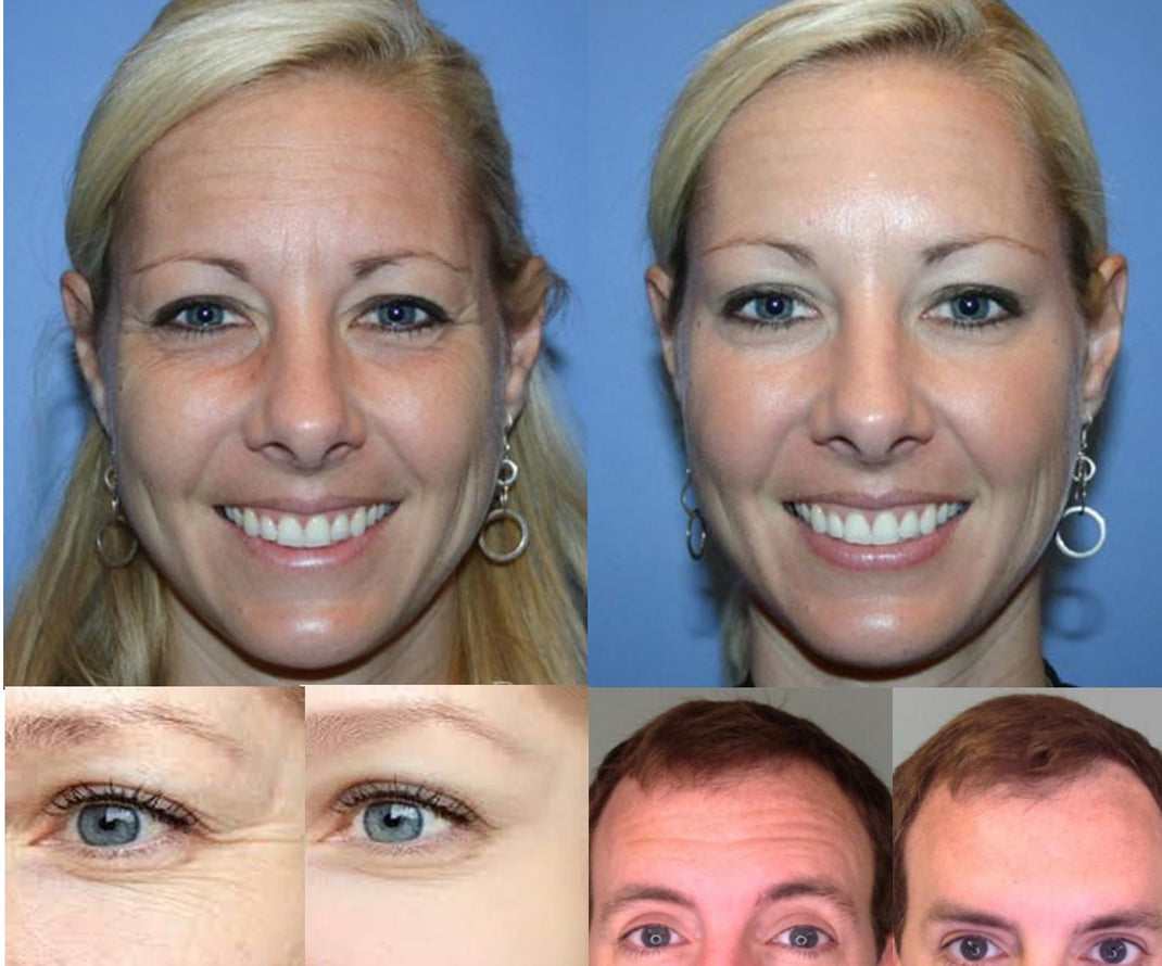 Injectable