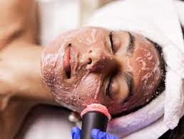 Esthetic Treatment - Oxygeneo Facial